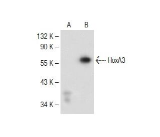 HoxA3 Antibody (F-7) - Western Blotting - Image 149482Each CRISPR/Cas9 Knockout (KO) Plasmid product consists of a pool of 3 plasmids designed to ensure identification and cleavage of a specific gene for maximum knockout efficiency. Each plasmid encodes a unique 20 nt sequence derived from the GeCKO (v2) library. 