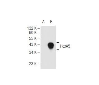 HoxA5 Antibody (129C1a) - Western Blotting - Image 68261 