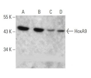 western blotting image from recommended HoxA9 (HOX5I043) monoclonal antibody replacement. Image 368226