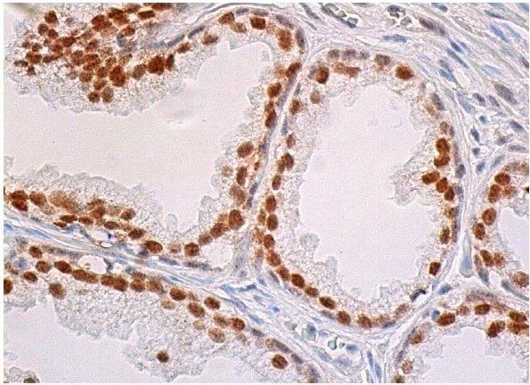 HoxB13 Antibody (F-9) | SCBT - Santa Cruz Biotechnology HoxB13 Antibody (F-9) | SCBT - Santa Cruz Biotechnology