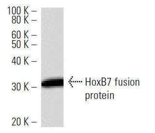 HoxB7 Antibody (747C4a) - Western Blotting - Image 16857