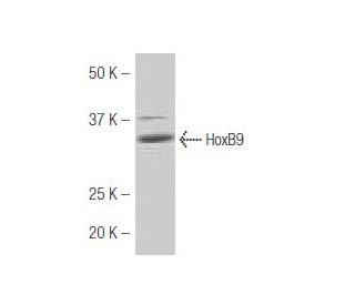 HoxB9 Antibody (45.9) - Western Blotting - Image 53867