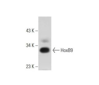 HoxB9 Antibody (H-8) - Western Blotting - Image 304997The Double Nickase Plasmid features a U6 promoter for sgRNA expression, a 20 nt targeting sequence, and a gRNA scaffold to guide Cas9n. It includes a CBh promoter for Cas9n (D10A) and puromycin resistance, GFP for transfection verification, and nuclear localization signals (NLS). The 2A peptide allows co-expression of Cas9n and Puro from a single promoter, enabling precise genome editing with reduced off-target effects.