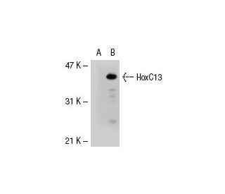HoxC13 Antibody (SS-39) - Western Blotting - Image 39078