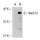 HoxC13 Antibody (SS-39) - Western Blotting - Image 39078