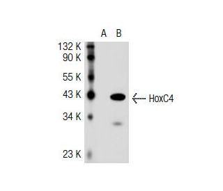 HoxC4 Antibody (RR-Y) - Western Blotting - Image 36996