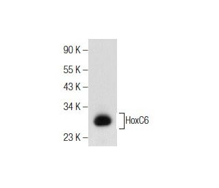 western blotting image from recommended HoxC6 (B-7) monoclonal antibody replacement. Image 155232
