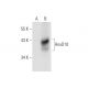 HoxD10 Antibody (B-10) - Western Blotting - Image 68603