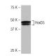 HoxD3 Antibody (4AY) - Western Blotting - Image 53868