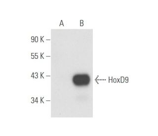 western blotting image from recommended HoxD9 (H-2) monoclonal antibody replacement. Image 58124