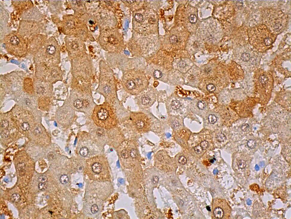 HPPD Antibody (B-11) | SCBT - Santa Cruz Biotechnology