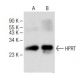 HPRT Antibody (F-12) - Western Blotting - Image 147717 