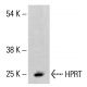 HPRT Antibody (F-12) - Western Blotting - Image 414490