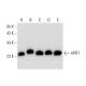 This polyclonal antibody has been discontinued. See our recommended <a href="hprt-antibody-f-1">HPRT (F-1)</a> monoclonal antibody (sample data shown). western blotting image from recommended HPRT (F-1) monoclonal antibody replacement. Image 299286