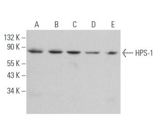 HPS-1 Antibody (5G12G2) - Western Blotting - Image 365628