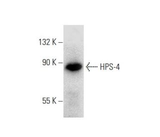 HPS-4 Antibody (D-10): sc-271425