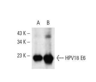 western blotting image from recommended HPV16 E6/18 E6 (C1P5) monoclonal antibody replacement. Image 61230