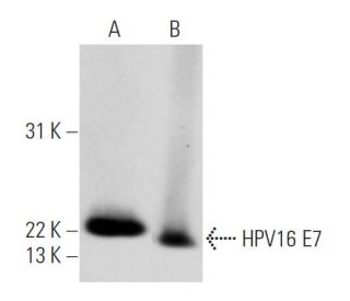 HPV16 E7 Antibody (716-325) - Western Blotting - Image 14093 