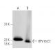HPV16 E7 Antibody (716-325) - Western Blotting - Image 14093 