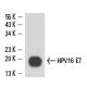 HPV16 E7 Antibody (716-325) - Western Blotting - Image 15599