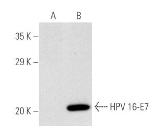 HPV16 E7 Antibody (ED17) - Western Blotting - Image 3650 