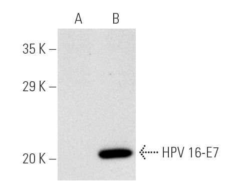 HPV16 E7 Antibody (ED17) | SCBT - Santa Cruz Biotechnology
