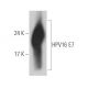 HPV16 E7 Antibody (ED17) - Western Blotting - Image 393598