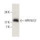 HPV16 E7 Antibody (ED17) - Western Blotting - Image 397939 