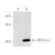이 다클론 항체는 생산이 중단되었습니다. 권장 <a href="hpv16-e7-antibody-ed17">HPV16 E7 (ED17)</a> 단클론 항체(샘플 데이터 표시)를 참조하세요. western blotting image from recommended HPV16 E7 (ED17) monoclonal antibody replacement. Image 3650