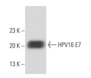 HPV16 E7 Antibody (NM2) - Western Blotting - Image 15574 