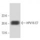 HPV16 E7 Antibody (NM2) - Western Blotting - Image 15574 