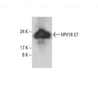HPV16 E7 Antibody (TVG710Y) - Western Blotting - Image 393546