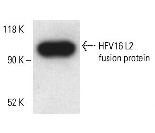 HPV16 L2 Antibody (2JGmab#5) - Western Blotting - Image 411074