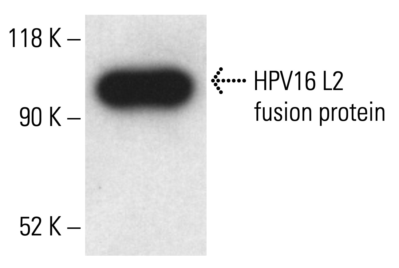 HPV16 L2 Antibody (2JGmab#5) | SCBT - Santa Cruz Biotechnology