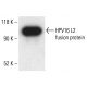 HPV16 L2 Antibody (2JGmab#4) - Western Blotting - Image 411073