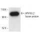 HPV16 L2 Antibody (2JGmab#8) - Western Blotting - Image 411075