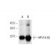 This polyclonal antibody has been discontinued. See our recommended <a href="hpv16-e6-18-e6-antibody-c1p5">HPV16 E6/18 E6 (C1P5)</a> monoclonal antibody (sample data shown). western blotting image from recommended HPV16 E6/18 E6 (C1P5) monoclonal antibody replacement. Image 61230