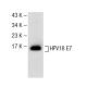 HPV18 E7 Antibody (F-7) - Western Blotting - Image 141520 