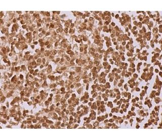 https://media.scbt.com/product/hrf-antibody-b-3-immunohistochemistry_38_80_b_388062.jpg