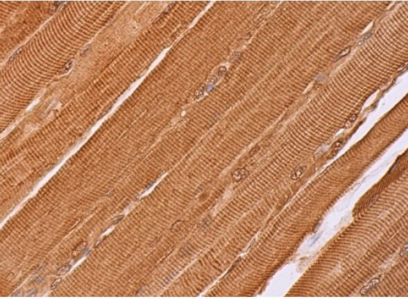 https://media.scbt.com/product/hrf-antibody-b-3-immunohistochemistry_38_80_z_388064.jpg