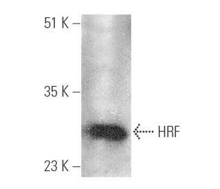 https://media.scbt.com/product/hrf-antibody-b-3-western-blotting_38_89_b_388950.jpg