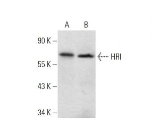 HRI Antibody (D-12) - Western Blotting - Image 138529