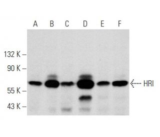 HRI Antibody (D-12) - Western Blotting - Image 356989The Double Nickase Plasmid features a U6 promoter for sgRNA expression, a 20 nt targeting sequence, and a gRNA scaffold to guide Cas9n. It includes a CBh promoter for Cas9n (D10A) and puromycin resistance, GFP for transfection verification, and nuclear localization signals (NLS). The 2A peptide allows co-expression of Cas9n and Puro from a single promoter, enabling precise genome editing with reduced off-target effects.