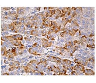 Hrs Antibody (D-11) - Immunohistochemistry - Image 159971 