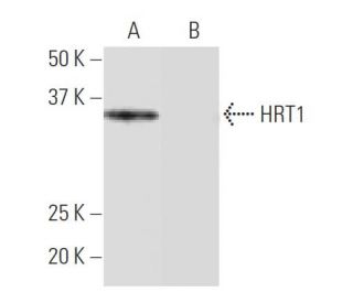 HRT1 Antibody (NB-A7) - Western Blotting - Image 64969