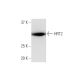 HRT2 Antibody (2B10) - Western Blotting - Image 347614 