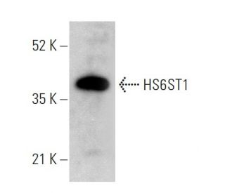 HS6ST1 Antibody (C-9) - Western Blotting - Image 379412Each CRISPR/Cas9 Knockout (KO) Plasmid product consists of a pool of 3 plasmids designed to ensure identification and cleavage of a specific gene for maximum knockout efficiency. Each plasmid encodes a unique 20 nt sequence derived from the GeCKO (v2) library.