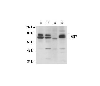 western blotting image from recommended HSF2 (G-11) monoclonal antibody replacement. Image 18286