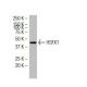 HSFX1 Antibody (5B12) - Western Blotting - Image 34423 
