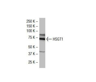 HSGT1 Antibody (RZ-17) - Western Blotting - Image 33507 